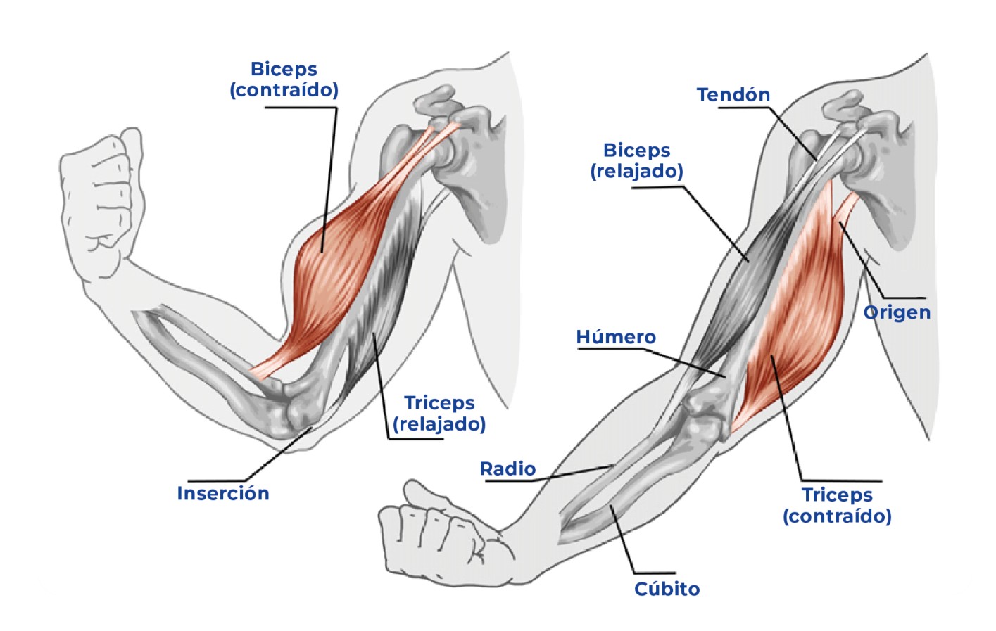 El brazo de Popeye 5 lesion brazo popeye esquema